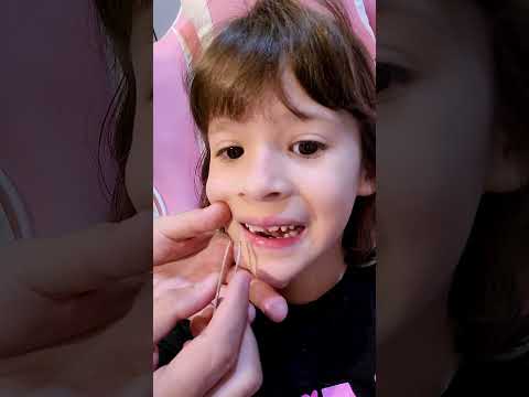 Lost another milk tooth 🦷