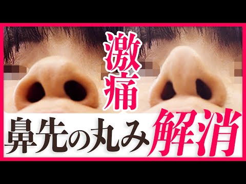 【激痛】3分で鼻先の丸みを解消する方法！