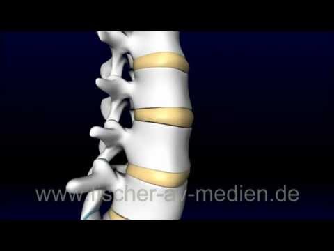 Para Vorsprung der Halswirbelsäule Entzündetes Gelenk des Daumens auf der Fußbehandlung