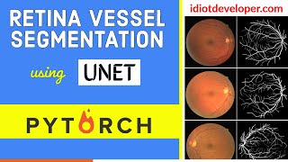 Download the video "UNET for Retina Blood Vessel Segmentation in PyTorch | Image Segmentation | Deep Learning"