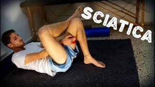 4 תרגילים מעולים לסיאטיקה