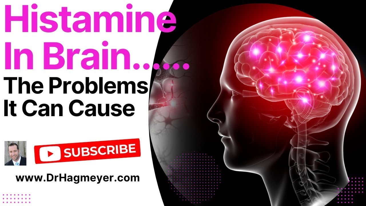 Is Excess Brain Histamine The Cause of Your Symptoms? Histamine causes brain fog