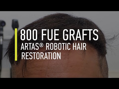 download lagu mp3 mp4 800 Grafts Fue, download lagu 800 Grafts Fue gratis, unduh video klip 800 Grafts Fue