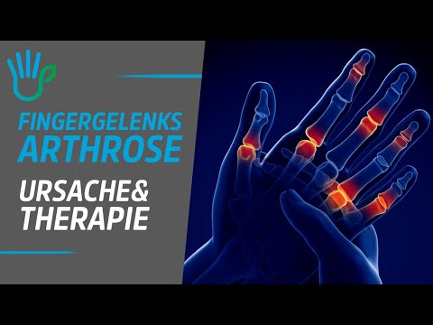 Milyen gyógyszereket kell bevenni a csípőízület osteoporosisához - investeurope.hu