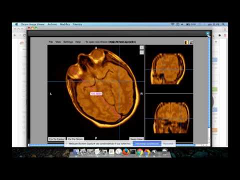 Dicom Medical Image Viewer video