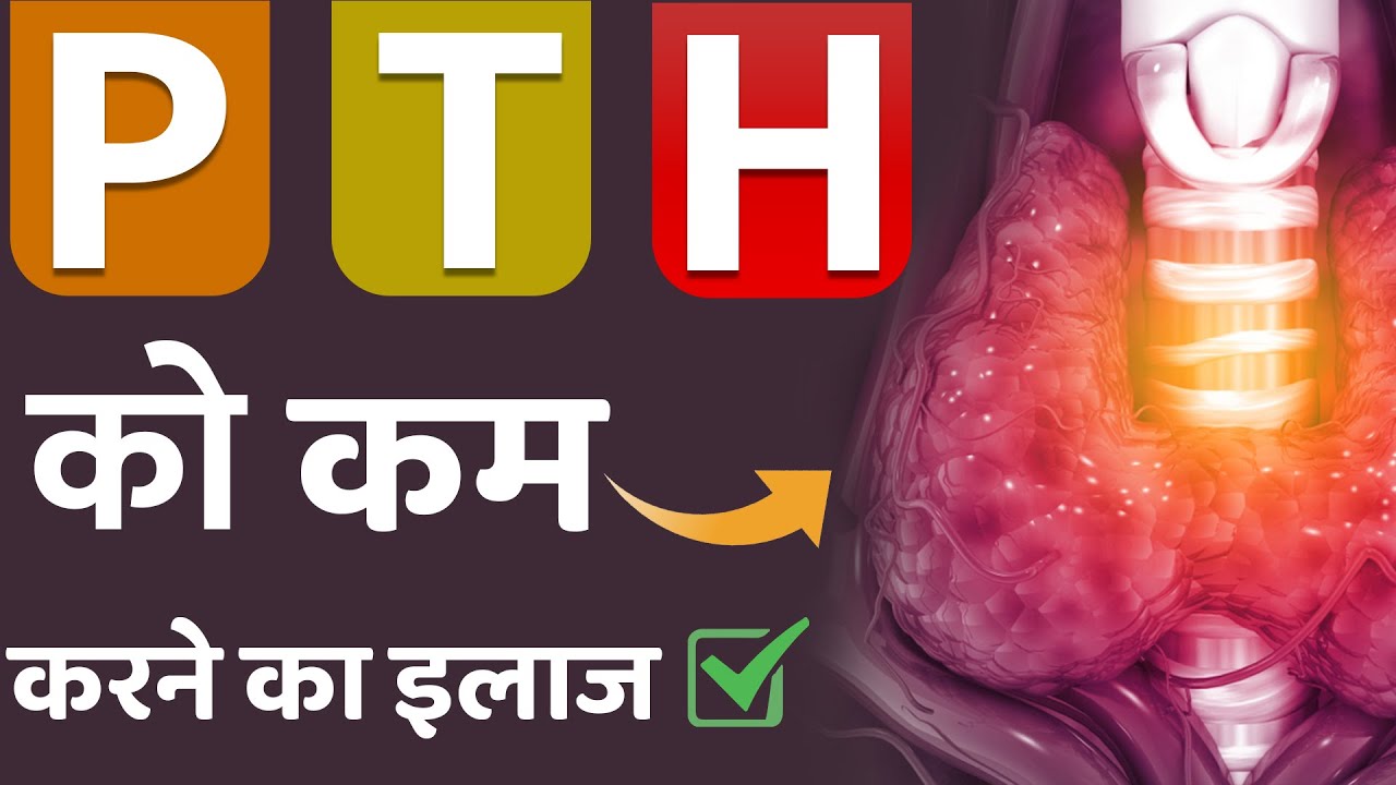 Watch video पैराथाइरॉइड हॉर्मोन को कम करने का इलाज Now पैराथाइरॉइड हॉर्मोन को कम करने का इलाज