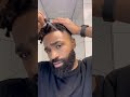 Onion Juice For A Receding Hair Line Shorts