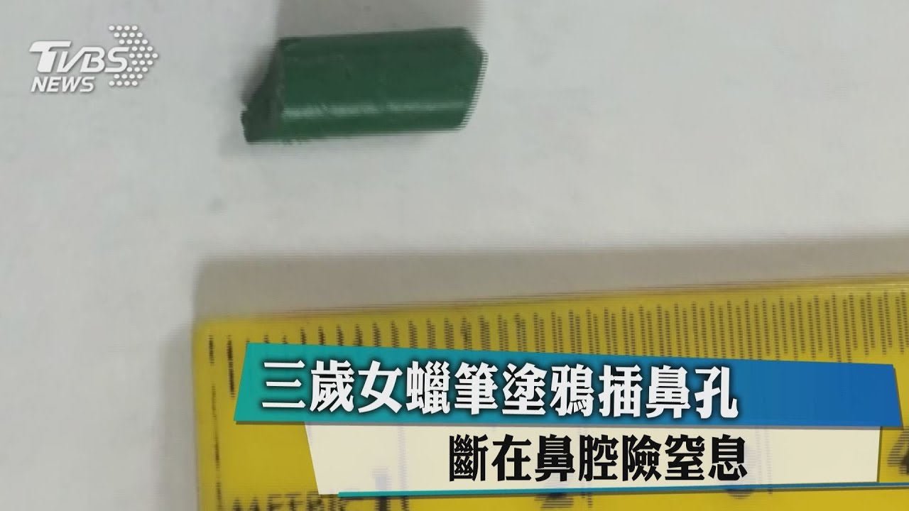 3歲女塗鴉蠟筆插鼻孔 斷在鼻腔險窒息