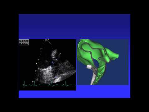 Rodney Horton   Tips and Tricks To Avoid Complications