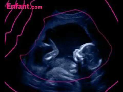 In utero journey: the 4th month