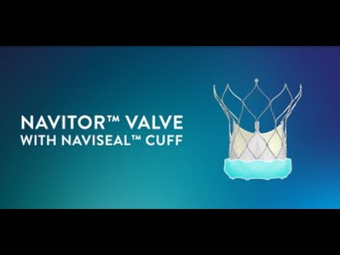 Navitor Valve with NaviSeal Cuff in Action Video