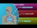 COPD