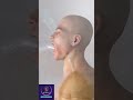 Risks About Anesthesia In A Surgery