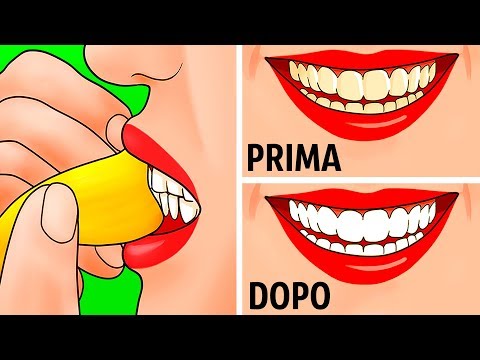 Borsite pietra nella spalla Possono sorgere da degenerativa pressione discopatia