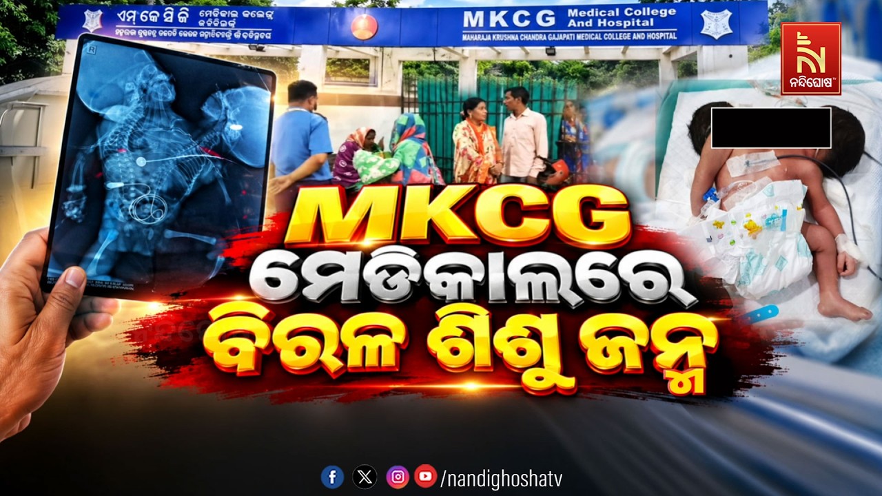 🔴Live | MKCG ମେଡିକାଲରେ ବିରଳ ଶିଶୁ ଜନ୍ମ