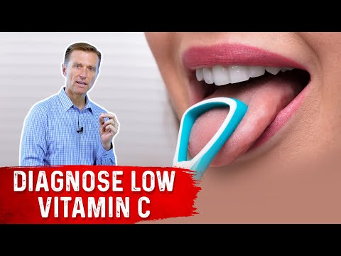 8 Signs of a Vitamin C Deficiency You ve Never Heard About