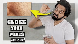 OPEN PORES PERMANENT SOLUTION (5 natural remedies) | #roadto100k