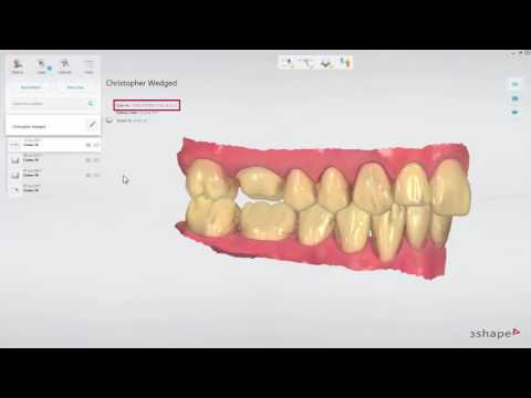How to Resend a Scan - Trios Video