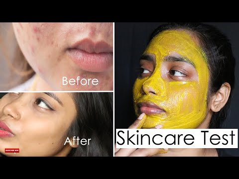 AVOID SKINCARE DISASTER BY DOING THIS FIRST | Skincare Test | How to do patch test at home