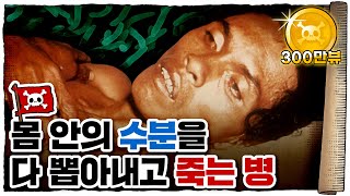 💀 설사가 사망플래그였던 이유...ㄷㄷ / 💀 코로나보다 무서웠던 콜레라