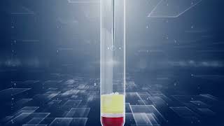 Kimya ve İmmünoassay Entegre Çözümü