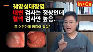 <Entity {'ja': '潰瘍性大腸炎の便検査は正常でしたが、血液検査の結果のみ数値が高く出ていました。体のどこかに炎症がありました。', 'ko': '궤양성대장염 대변 검사는 정상인데 혈액 검사만 높았습니다.  몸 어딘가에 염증이 있었습니다.', 'en': 'The stool test for ulcerative colitis was normal, but the blood test results were high. There was inflammation somewhere in the body.'}>