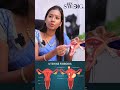Fibroids இங்க இருந்தா Periods அதிகமா வரும் Dr Nandhini E