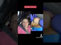 EXTRACTION OF A TOOTH LIKE INGROWN Shorts Ingrowntoenail