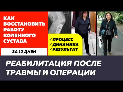 Перелом мыщелка большеберцовой кости: реабилитация после операции