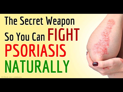 Natural Solutions for Psoriasis