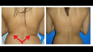 How to Lose Back Fat For Women: How to Get Rid of Upper, Lower Back Fat for women