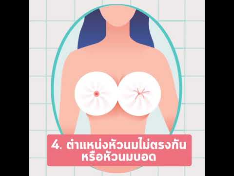 ทำไมเด็กดูดหน้าอกเล็ก ๆ น้อย ๆ ของเวลา ไม่ว่าจะเป็นหน้าอกตกหลังจาก mammoplasty