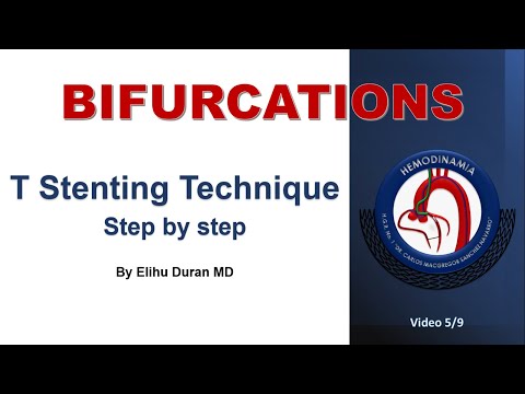 T Stent