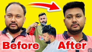 आज लगवालो बाल कल नहीं रहोगे परेशान | Hair Patch Centre | Hair Patch For Men | call us 9599858612
