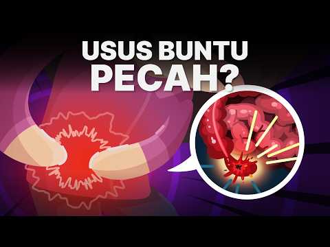 Apa yang Terjadi Jika Usus Buntu Kita Pecah?
