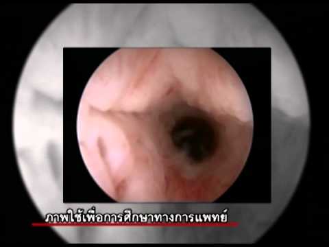 ยาแรงโฆษณา ความอ่อนแอของความตื่นเต้น