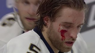 Gotta See It: Ekblad shaken after taking puck to the face