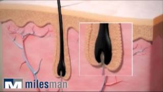 Entender la depilación en 5 minutos