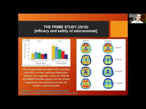 Marcin Kopka | Dementia Webinar| 2021| Neuroscience| Confrontiers Conferences LLP