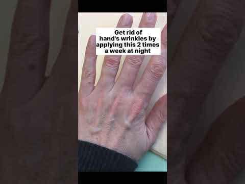 Get rid of hand's wrinkles| wrinkled hands #wrinkles #shorts #skin