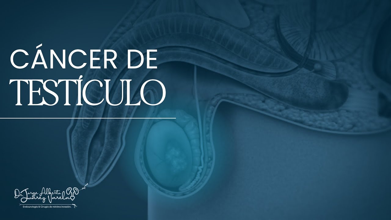 Jorge Alberto Juárez Varela-86