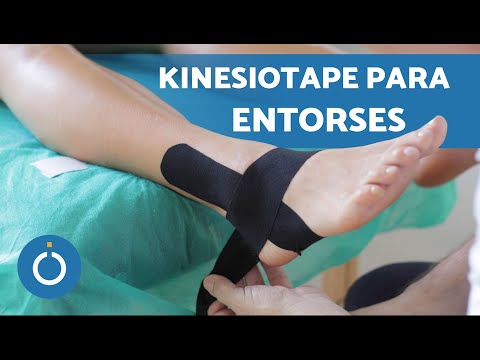 Vídeo: Como colocar kinesio no tornozelo: perguntas