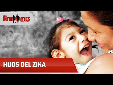 Son más de 300 niños con microcefalia que ahora forman la generación del zika - Los Informantes