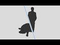 Pig Human Chimeras Could Help Grow Human Organs
