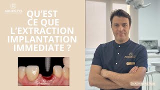 Extraction Implantation immédiate
