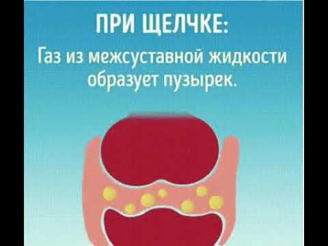 Деформирующий спондилёз шейного отдела позвоночника Резкая боль в пояснице стоя
