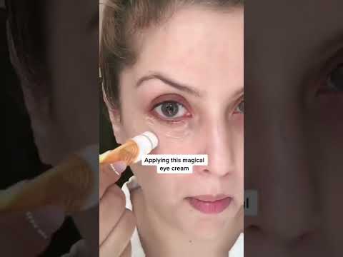 Best eye cream for dark circles