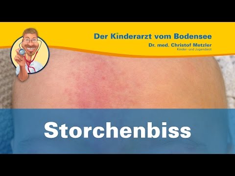 Das Ekzem auf der Person vom Alkohol Das Ekzem auf den Fingern der Hände der Folge