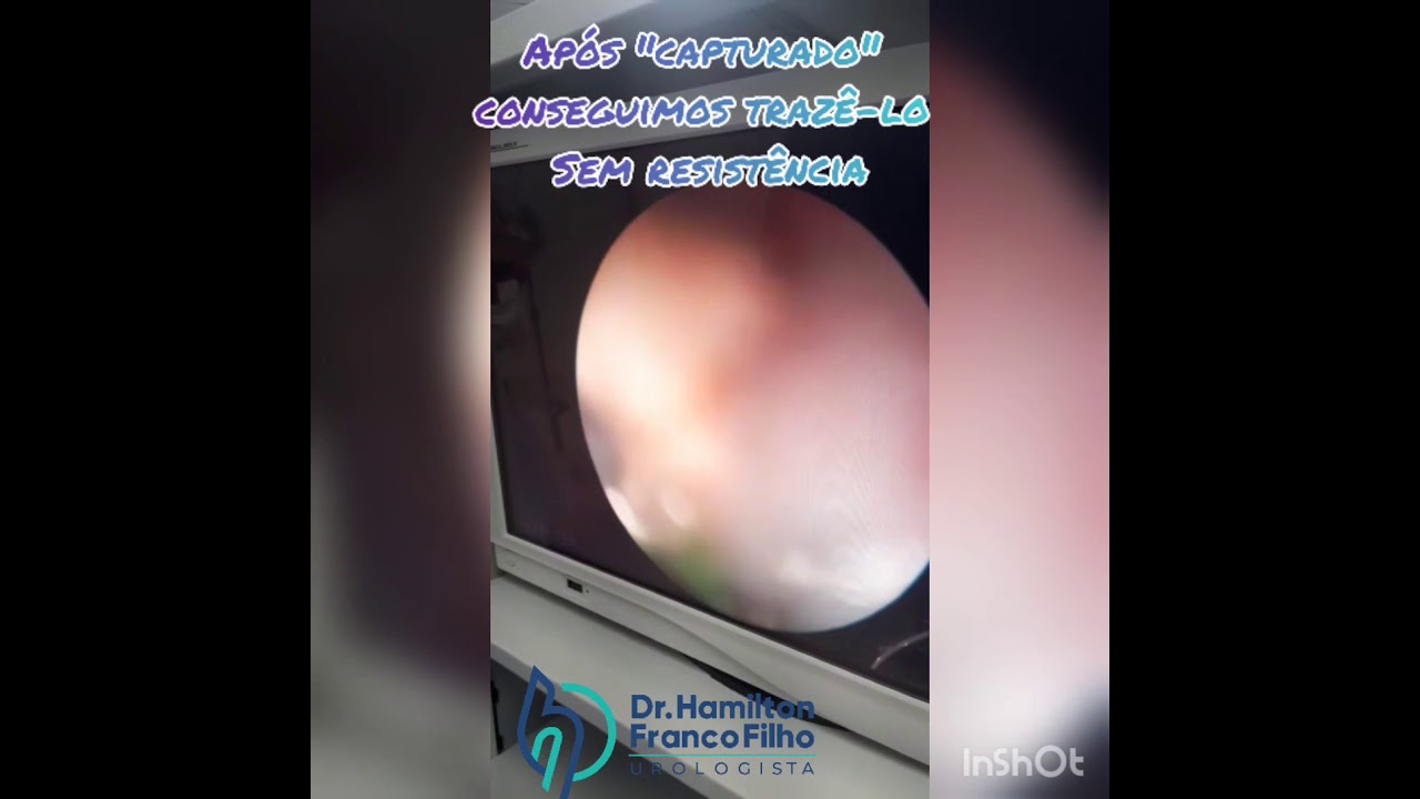 Hamilton Franco Filho-54