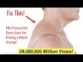 How to Fix a Neck Hump at Home (FAST) | With FREE Exercise Sheet!